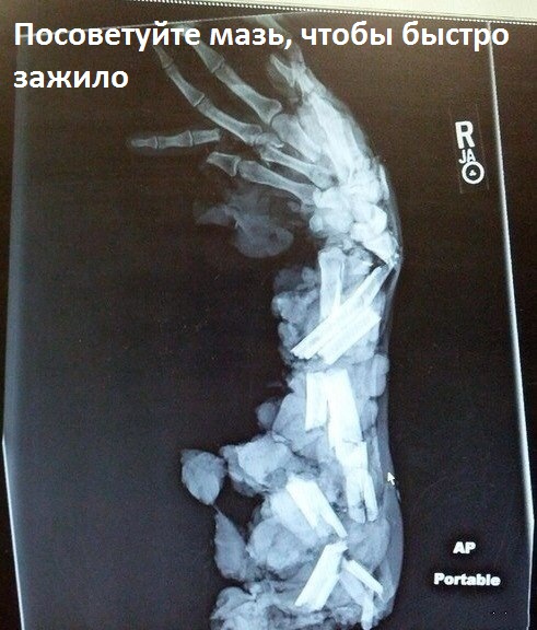 Посоветуйте мазь.